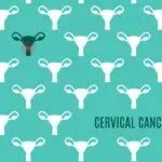 The Importance of Cancer Screening in Modern Healthcare