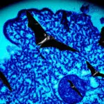 Understanding the Nipah Virus Outbreak in India