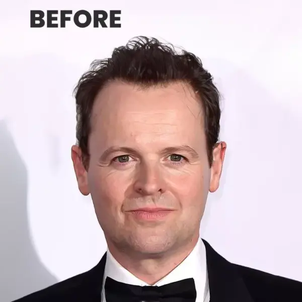 The Life and Career of Declan Donnelly