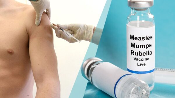 The Resurgence of Measles: A Public Health Alert