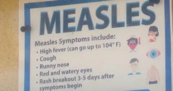 Identifying Measles Symptoms: A Public Health Concern