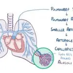 Understanding Pulmonary Embolism: Risks, Symptoms and Treatments