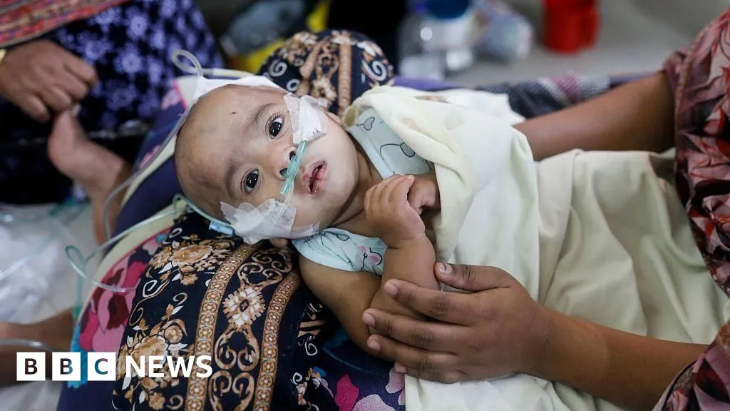 Bbc: Measles Outbreaks and Iranian Family Divisions: A Update